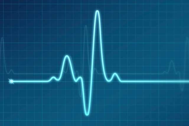 EKG/Electrocardiogram